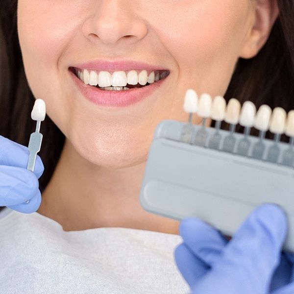Blanqueamiento Dental